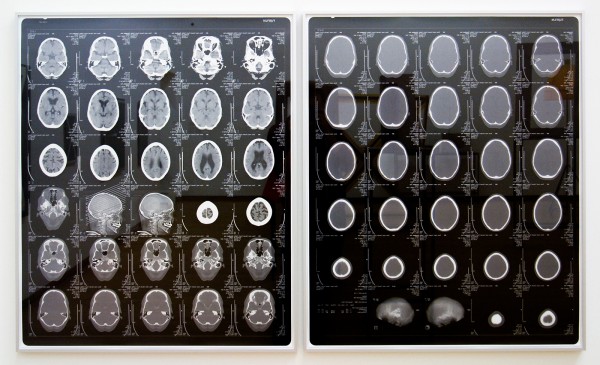 Isa Genzken - Mein Gehirn - Zilvergelatinedruk