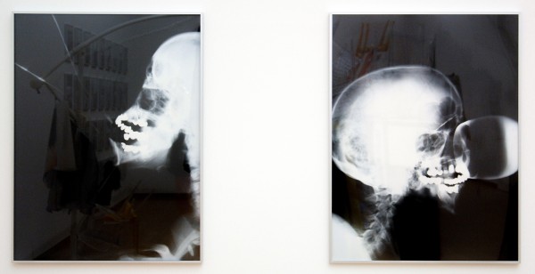 Isa Genzken - X-Ray & X-Ray - Chromogene kleurendruk